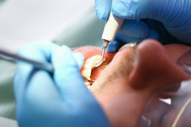 Best Emergency Treatment for Toothache in Grissom Af, IN
